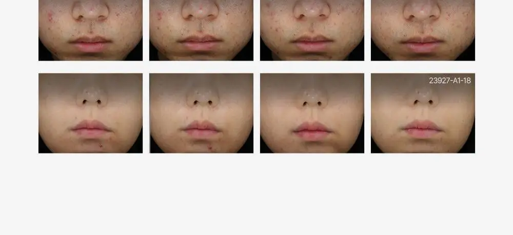 [트러블부위 진정케어] 피캄 센텔라 트러블 스팟 15ml 상세페이지 28